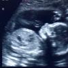 View the image: Ultrasound 12/15/2010